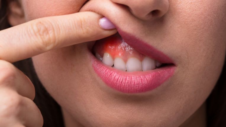 Tooth Sensitivity : Causes and Complete Solutions