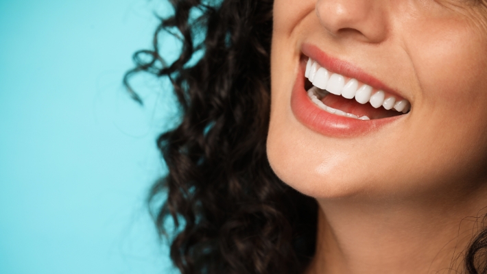 Dental Veneers: How to Manage Expectations and Outcomes?